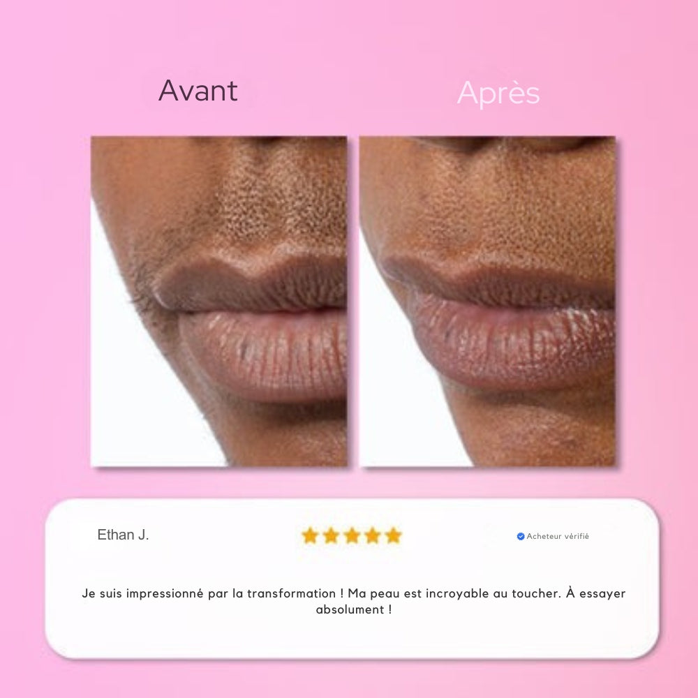 Soléa Épilation instantanée pour le visage et menton