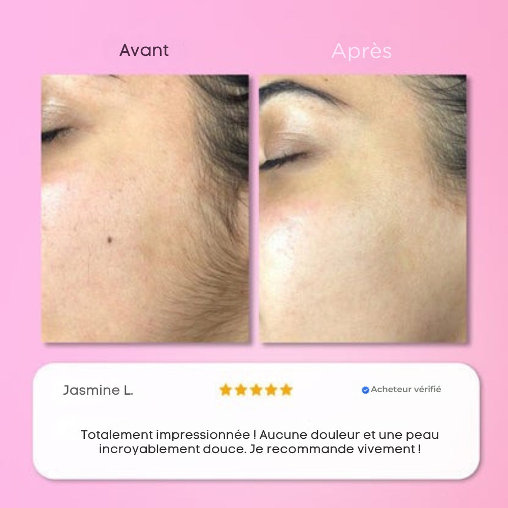 Soléa Épilation instantanée pour le visage et menton